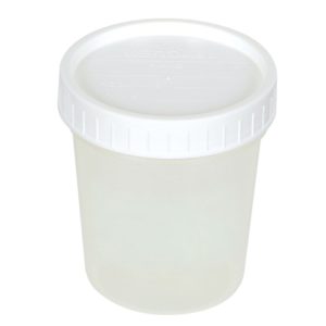 Image of cup for urine
